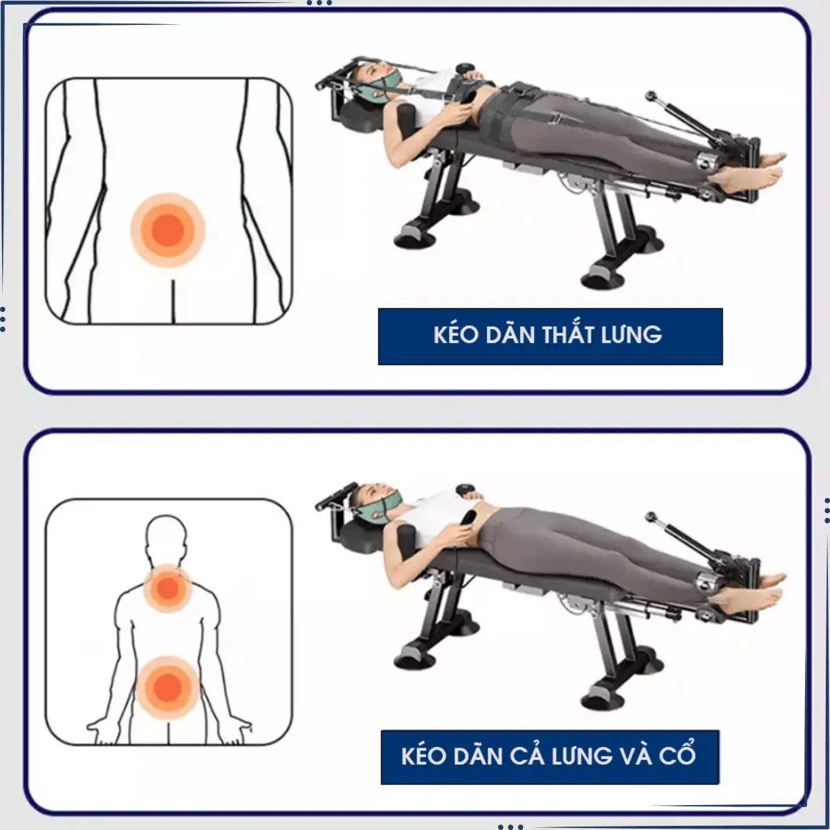 Các trường hợp chỉ định sử dụng máy kéo giãn cột sống Rowanto Smart Control