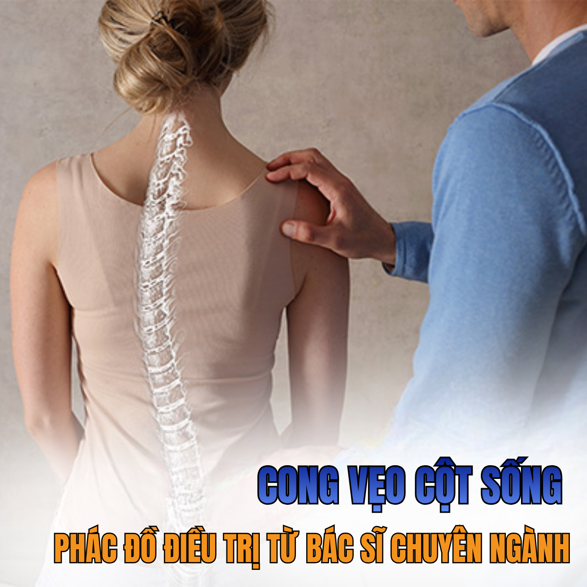 Phác Đồ Điều Trị Cong Vẹo Cột Sống Được Bác Sĩ Khuyên Dùng